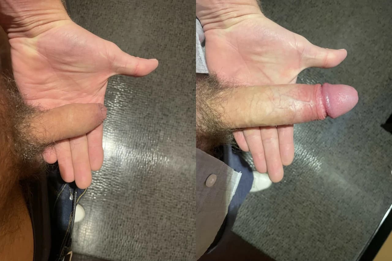 Anonymous adult photo by Her Superdick shared 3/31/2023 on InstaDick